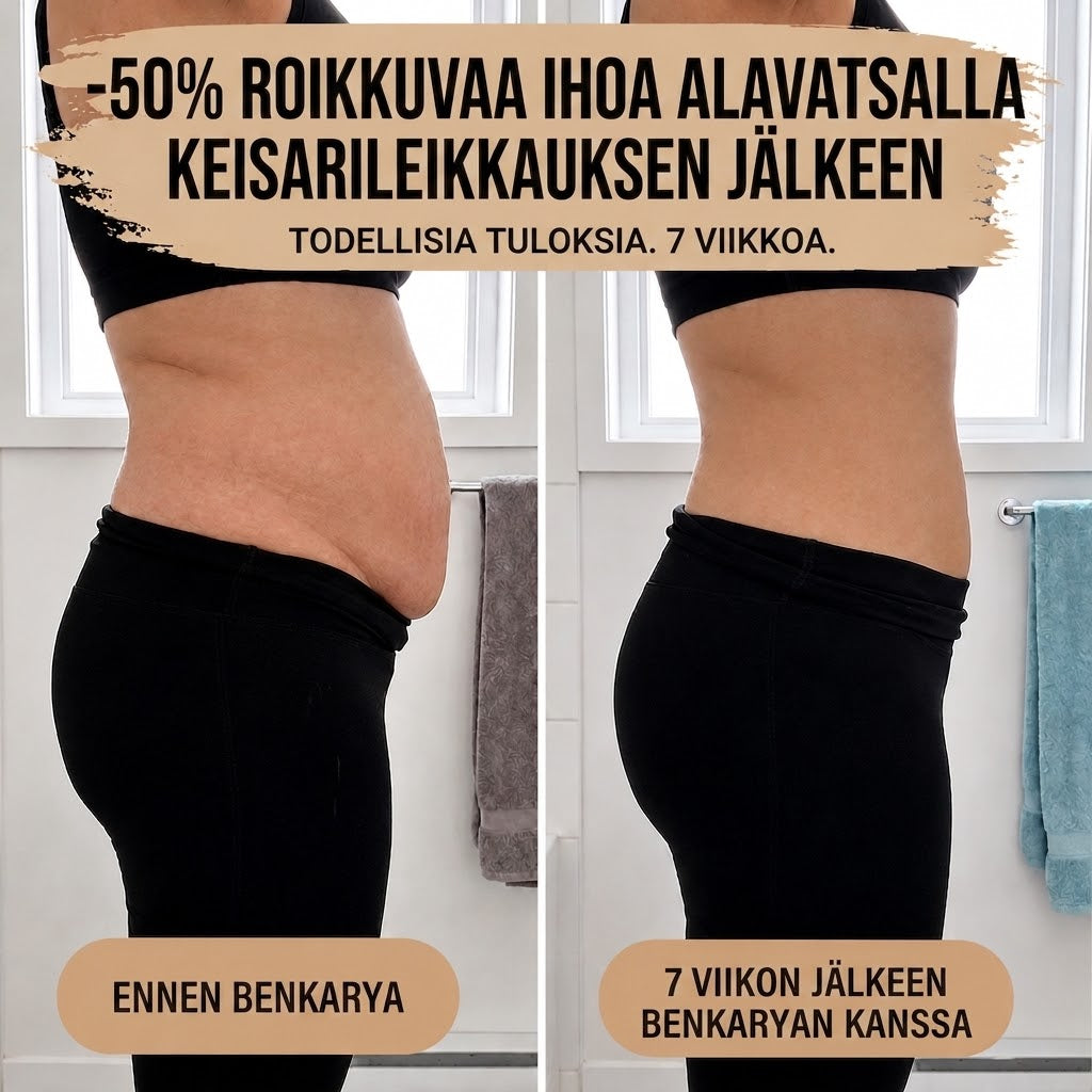 Synnytyksen jälkeinen – 360° kompressio