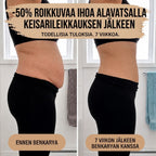 Synnytyksen jälkeinen – 360° kompressio