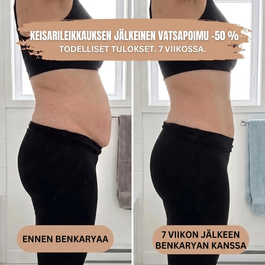 Synnytyksen jälkeiset tukihousut – 360° kompressio